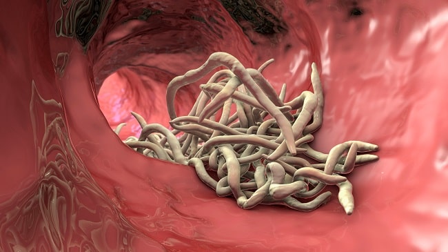 Cacing Ascariasis lumbricoides